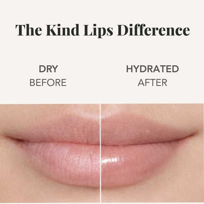 Kind Lips Variety 5 Pack