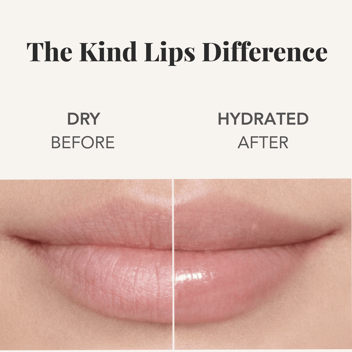 Kind Lips Variety 5 Pack Lip Balm Pack Kind Lips 