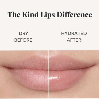 Kind Lips Variety 5 Pack Lip Balm Pack Kind Lips 